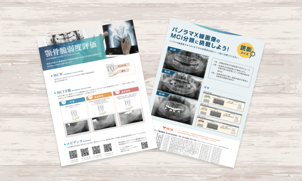 X線画像分析ツールの商品案内チラシ｜株式会社アイウェイヴ パンフレット制作・リーフレット/チラシ作成