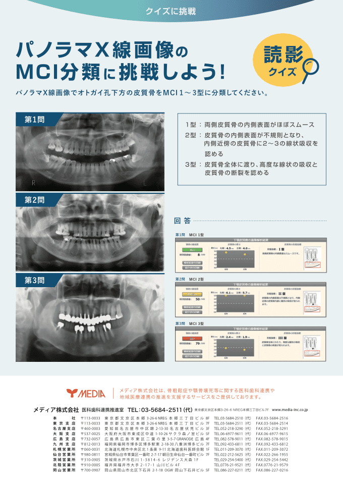 X線画像分析ツールの商品案内チラシ｜株式会社アイウェイヴ パンフレット制作・リーフレット/チラシ作成